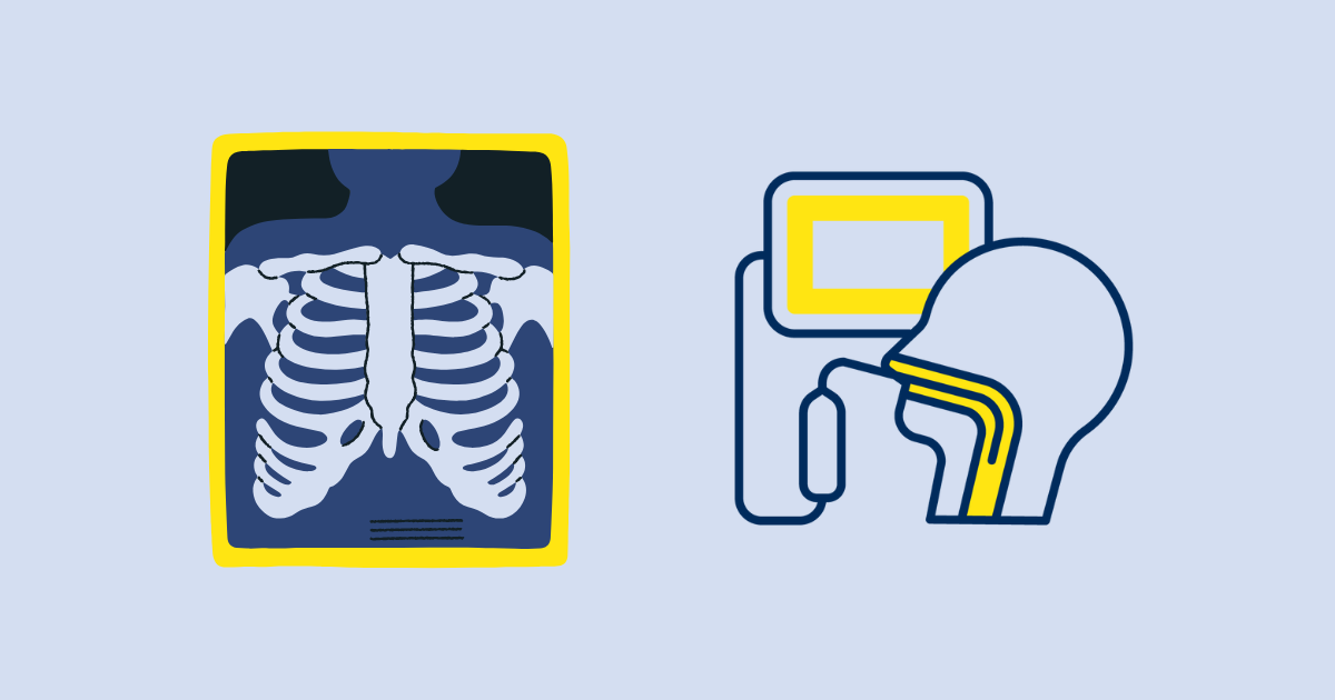 Videofluoroscopy vs Flexible Endoscopic Evaluation of Swallowing